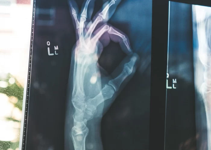this-world-osteoporosis-day-remember-to-love-your-bones